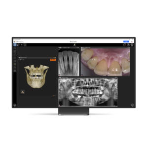 Carestream CS Imaging Version 8 – Bildgebungssoftware